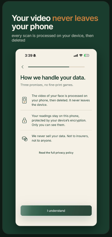 How Linden handles your data — the video never leaves your phone